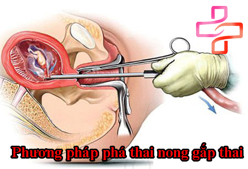 phuong-phap-nong-gap-thai