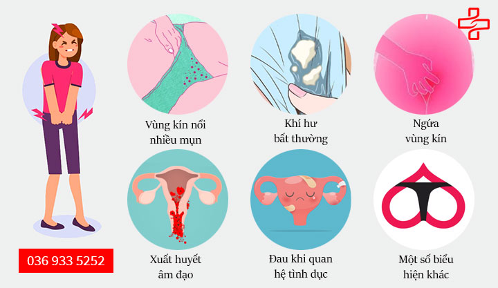 6 dấu hiệu nhận biết viêm vùng kín ở nữ giới “chuẩn không cần chỉnh”