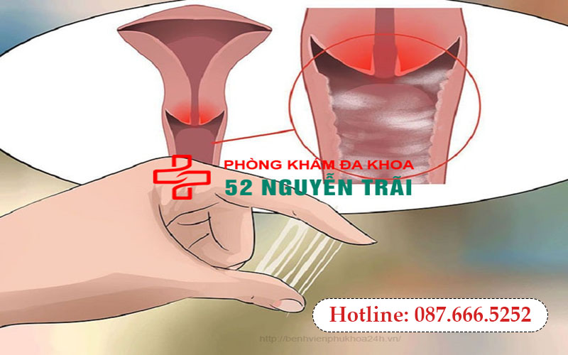 am dao ra mu bat thuong nu gioi 1