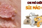 Chữa sùi mào gà bao tiền ? Địa chỉ khám và chữa bệnh sùi mào gà uy tín, tiết kiệm chi phí.