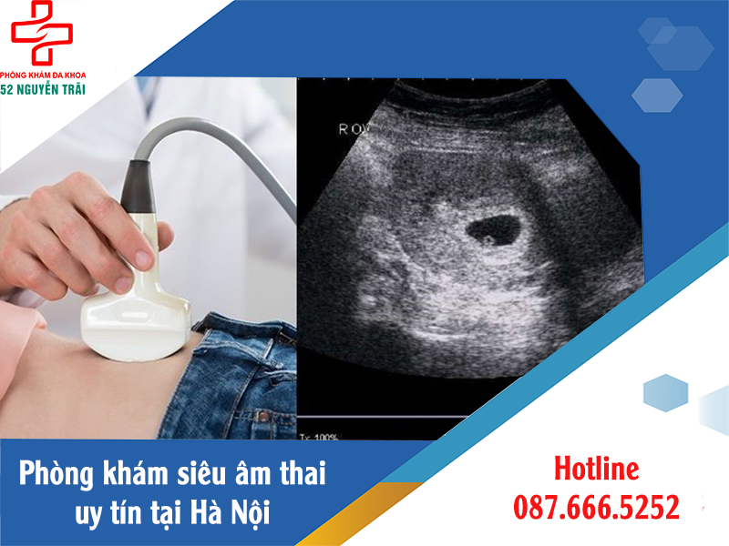 Đi tìm phòng khám siêu âm thai uy tín chất lượng tại Hà Nội
