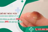 Ra khí hư màu nâu: Dấu hiệu cảnh báo bệnh lý chớ chủ quan