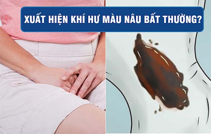 khí hư màu nâu