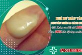 Khí hư màu vàng có bất thường không? Nguyên nhân và Cách chữa