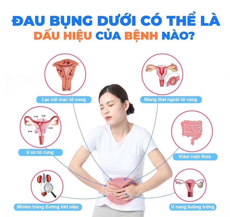 đau bụng dưới là bệnh gì