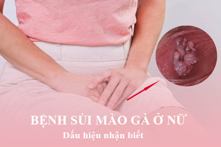sui-mao-ga-nu-1