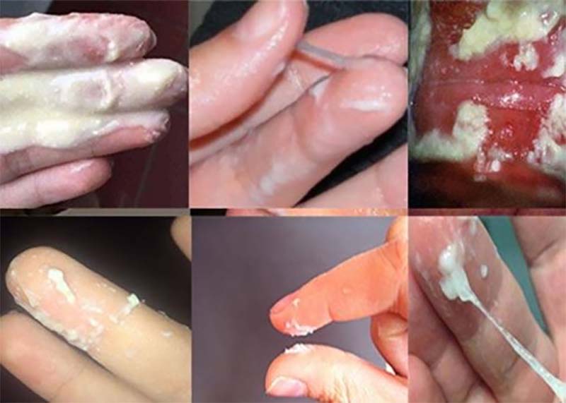 Bác Sĩ Phụ Khoa Hà Nội Chia Sẻ Cách Xử Lý Khí Hư Bất Thường Dứt Điểm