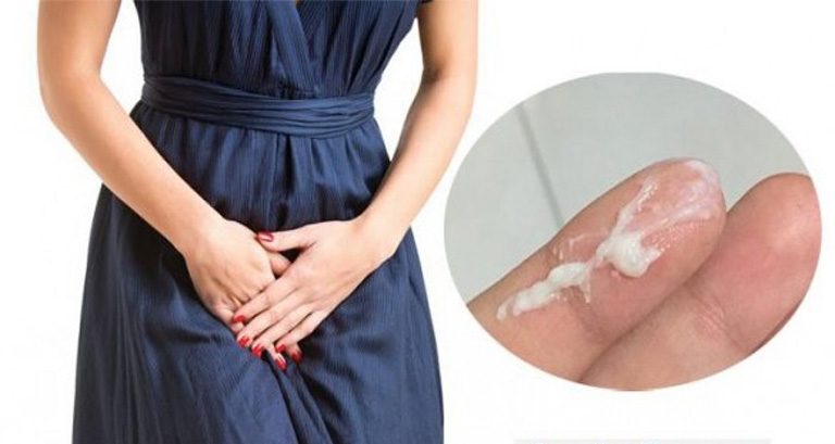 Ra Khí Hư Vón Cục Như Bã Đậu Là Dấu Hiệu Bệnh Gì? Nguy Hiểm Không? 10 khí hư vón cục