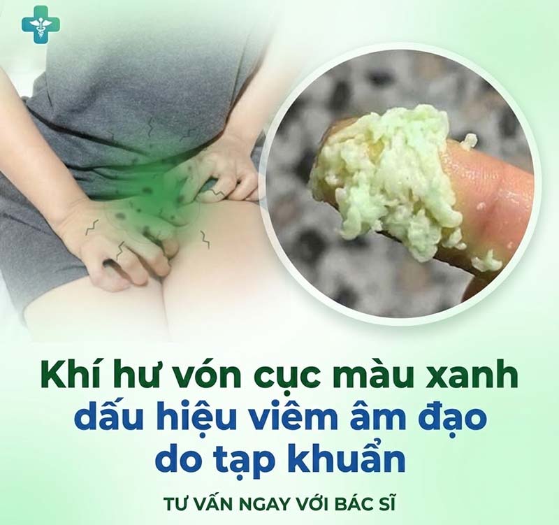 Ra Khí Hư Vón Cục Như Bã Đậu Là Dấu Hiệu Bệnh Gì? Nguy Hiểm Không?