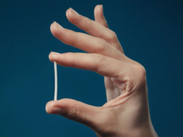 Cấy Que Tránh Thai Tại Hà Nội – Tư Vấn Bác Sĩ