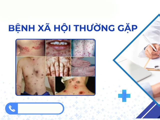 Phòng Khám Nam Học Hà Nội 52 Nguyễn Trãi 18 Điều-trị-bệnh-xã-hội