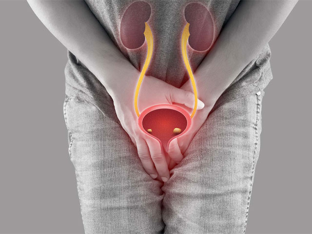 Tiểu Buốt, Tiểu Rát Có Phải Bệnh Niệu Đạo? 9 Điều-trị-viêm-niệu-đạo