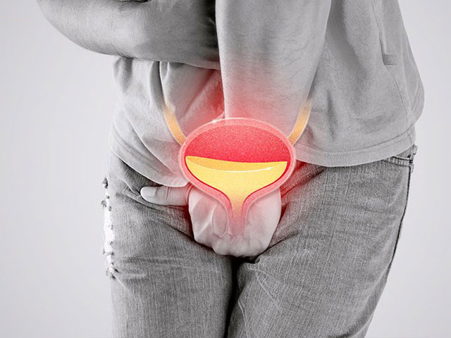 Tiểu Buốt, Tiểu Rát Có Phải Bệnh Niệu Đạo? 4 Hẹp niệu đạo