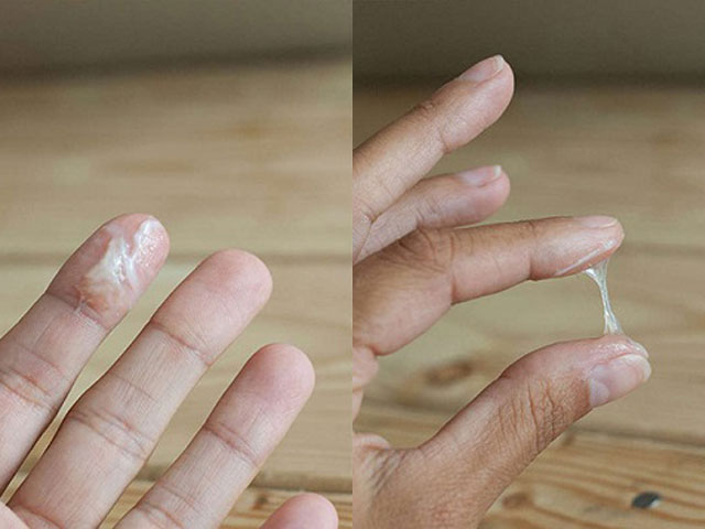 Phòng Khám Phụ Khoa Tốt Nhất Hà Nội – Bác Sĩ Giỏi 4 Khí-hư-ra-nhiều,-có-mùi-hôi,-màu-lạ