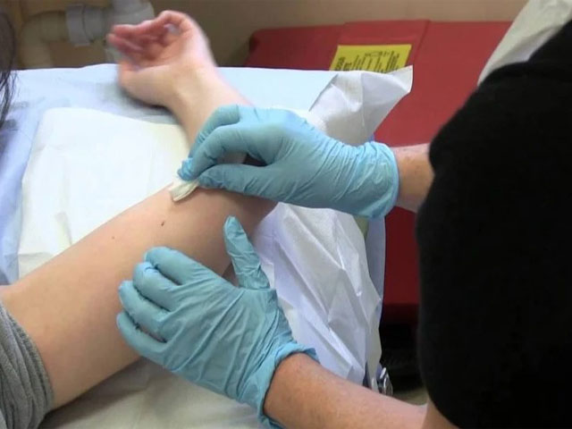 Cấy Que Tránh Thai Tại Hà Nội – Tư Vấn Bác Sĩ 2 Những-đối-tượng-nên-cấy-que-tránh-thai