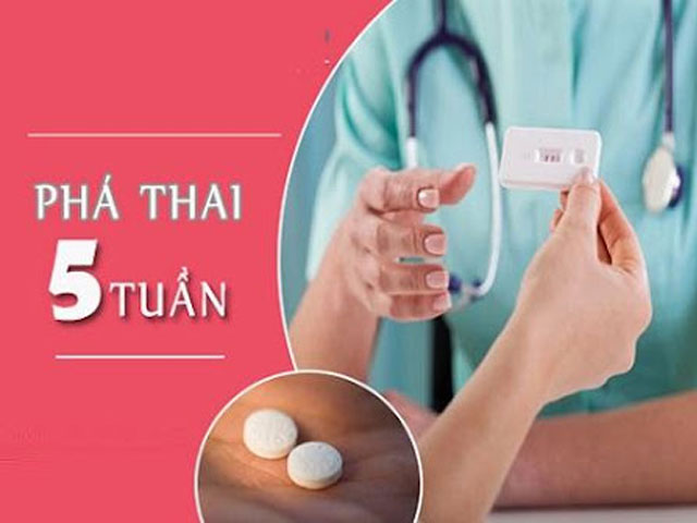 Phá Thai 5 Tuần Tuổi Ở Đâu An Toàn? Tư Vấn Bác Sĩ