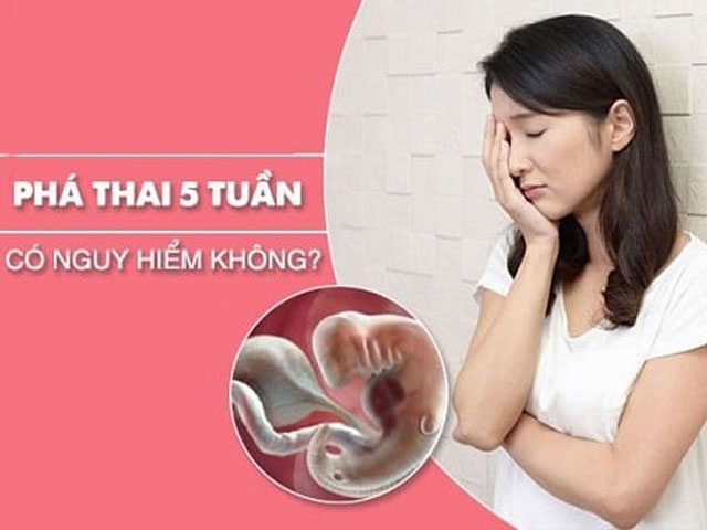 Phá Thai 5 Tuần Tuổi Ở Đâu An Toàn? Tư Vấn Bác Sĩ 5 Phá-thai-5-tuần-tuổi-có-được-không
