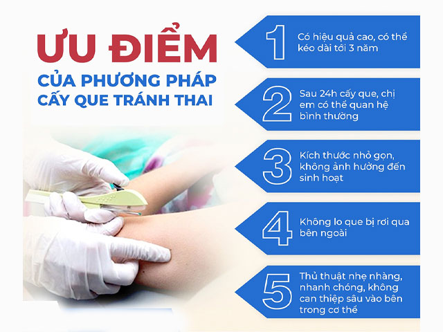 Cấy Que Tránh Thai Tại Hà Nội – Tư Vấn Bác Sĩ 3 Ưu-điểm-của-phương-pháp-cấy-que-tránh-thai